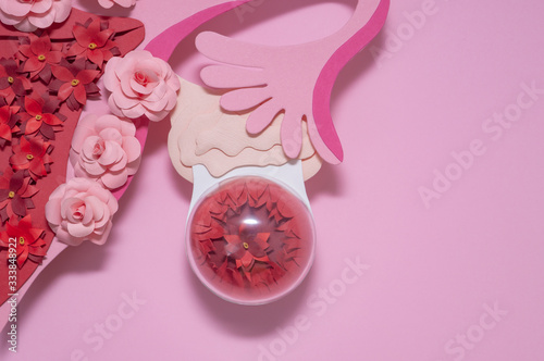 The creative concept of endometrioid ovarian cyst. Copy space for text