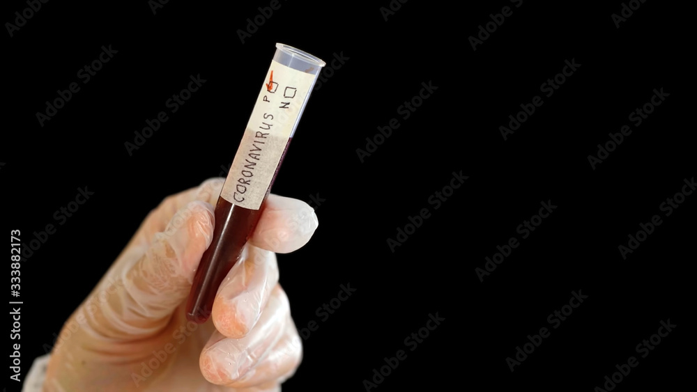 Fototapeta premium Scientist holding test tube with with positive results to CORONAVIRUS COVID-19 on black background.