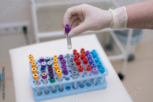 Close-up of doctor wearing medical glove taking tubes for blood test. View from above. Unrecognizable researcher taking test tube for doing biochemical analysis. Concept of healthcare and medicine.