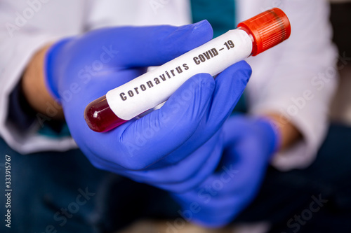 2019-nCoV Coronavirus. Posi...