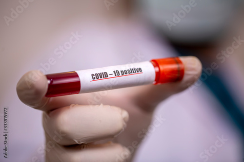 2019-nCoV Coronavirus. Posi...