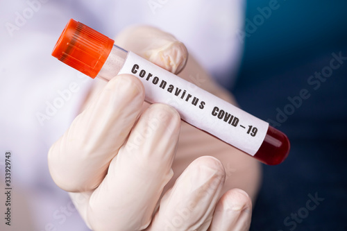 2019-nCoV Coronavirus. Posi...