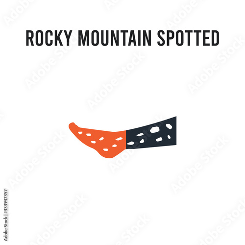 Rocky Mountain spotted fever vector icon on white background. Red and black colored Rocky Mountain spotted fever icon. Simple element illustration sign symbol EPS