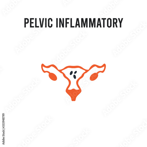 Pelvic inflammatory disease vector icon on white background. Red and black colored Pelvic inflammatory disease icon. Simple element illustration sign symbol EPS