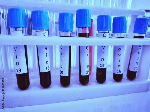 the COVID-19 Virus infection was tested from Blood sample in small glass test tubes in medical science laboratory  photo