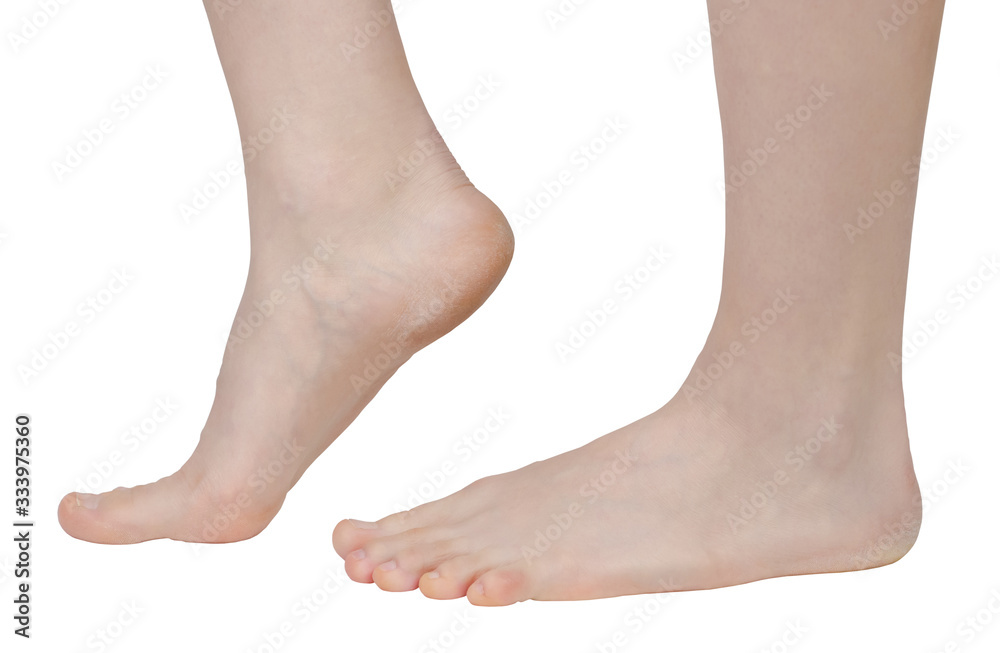 bare female legs, stupas with problematic, dry skin, with flat feet of the foot close-up isolated on a white background bare female legs, stupas with problematic, dry skin, with flat feet of the foot close-up isolated on a white background