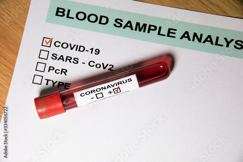 Probeta sobre formulario de resultados de análisis de sangre de Coronavirus o Covid19 