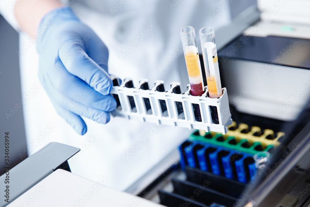 Nurse microbiologist holding test tube with blood for coronavirus 2019-nCoV analyzing Nurse microbiologist holding test tube with blood for coronavirus 2019-nCoV analyzing