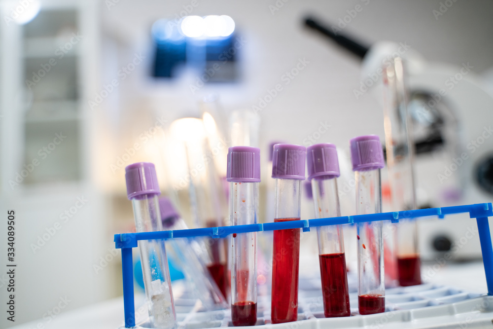 laboratory table laboratory table