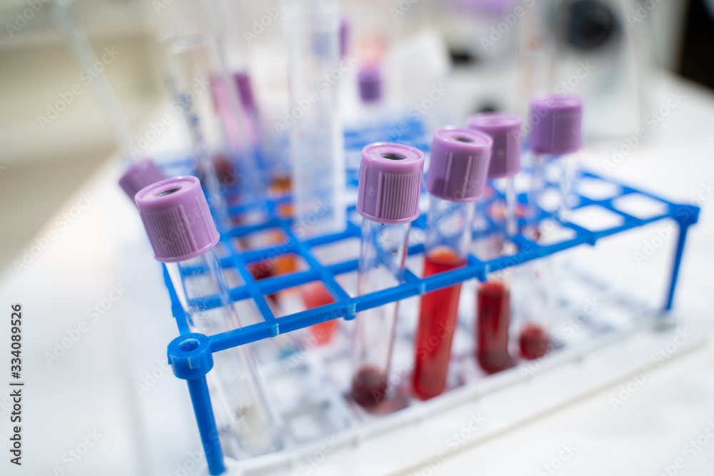 laboratory table laboratory table