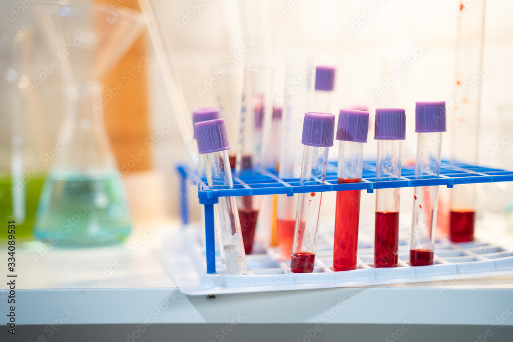 laboratory table laboratory table