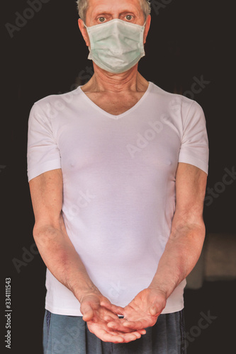 ill elderly man with  phlebitis in the arms