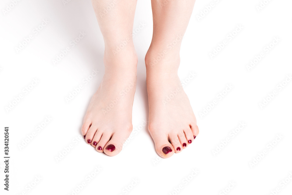 Hallux valgus on female legs on a white background. A bump on female legs close-up. Hallux valgus on female legs on a white background. A bump on female legs close-up.