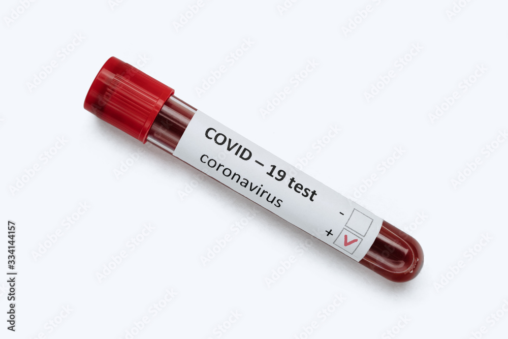 Test tube with COVID-19 infected blood samples isolated on white background. Coronavirus outbreak and vaccine research concept. Copy space. Test tube with COVID-19 infected blood samples isolated on white background. Coronavirus outbreak and vaccine research concept. Copy space.