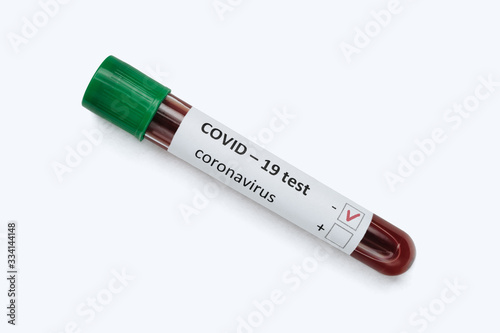 Green sample tube with patient blood, negative COVID-19 test isolated on white background. Coronavirus 2019 found in Wuhan, China. Copy space