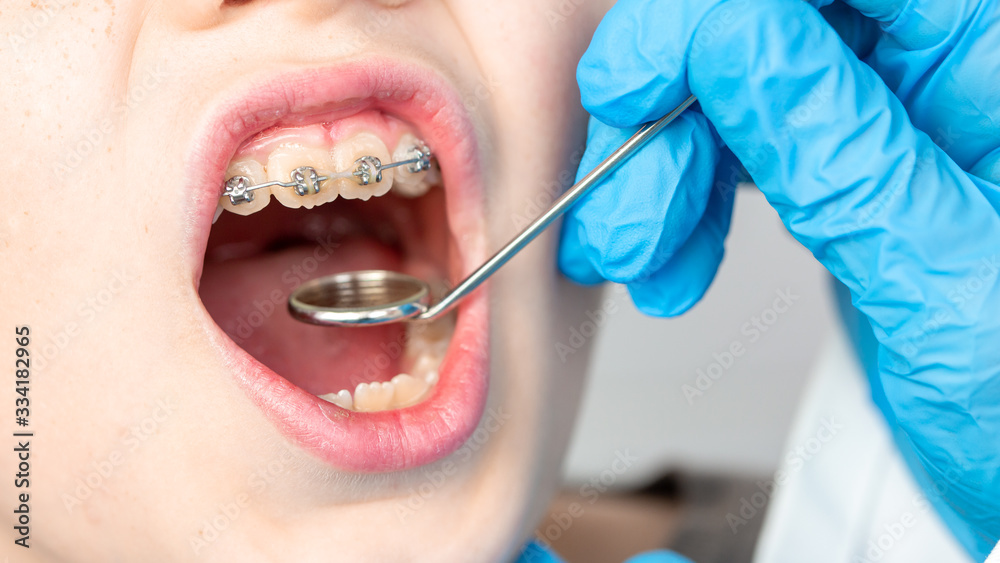 Dentist using an instrument to visualize the teeth of a child patient Stock Photo Adobe Stock