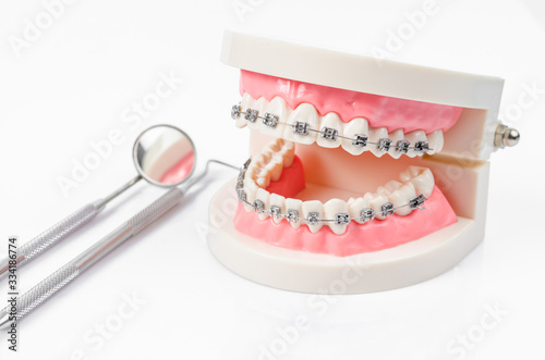 Fotografía tooth model with metal wire dental braces and mirror dental equipment