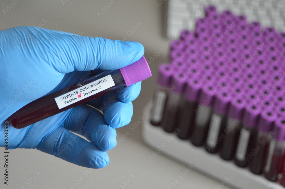 Positive blood test result for the Coronavirus Covid-19
