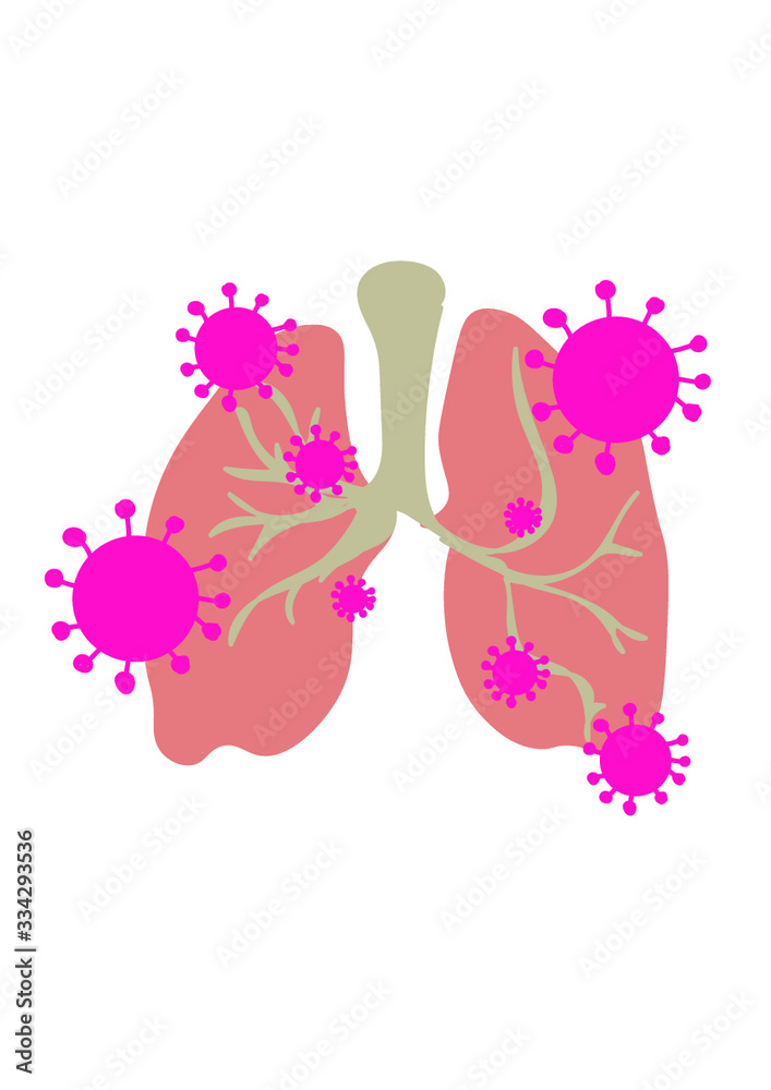 Corona Virus In Lungs - Microbiology And Virology Concept