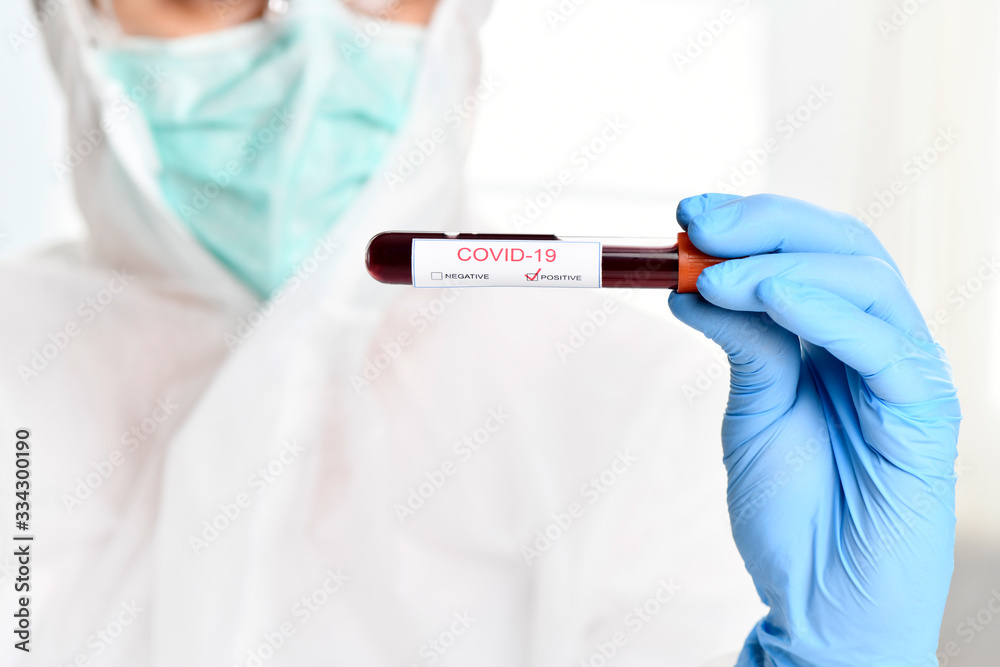 COVID-19 or Coronavirus Positive Blood Test COVID-19 or Coronavirus Positive Blood Test