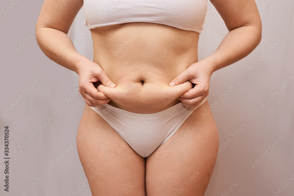 Fat unhealthy woman body. Pinch belly side. Measurement lady procedure. Medicine pinching. Anti cellulite overweight.