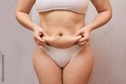 Fat unhealthy woman body. Pinch belly side. Measurement lady procedure. Medicine pinching. Anti cellulite overweight. photo