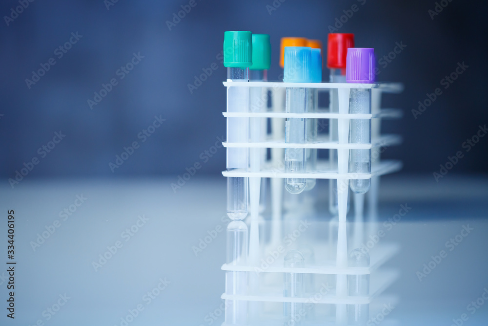 Test tubes for blood analysis. Check for the virus. Medical Devices Test tubes for blood analysis. Check for the virus. Medical Devices