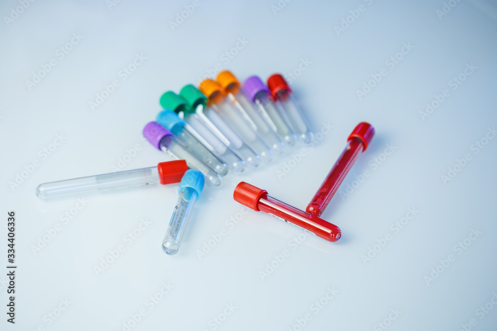 Test tubes for blood analysis. Check for the virus. Medical Devices Test tubes for blood analysis. Check for the virus. Medical Devices