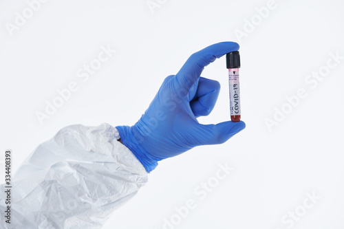 Coronavirus, Doctor holding positive covid-19 virus Blood Sample tube white background