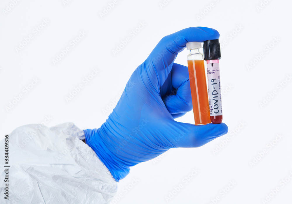 Coronavirus, Doctor holding positive covid-19 virus Blood Sample tube white background Coronavirus, Doctor holding positive covid-19 virus Blood Sample tube white background