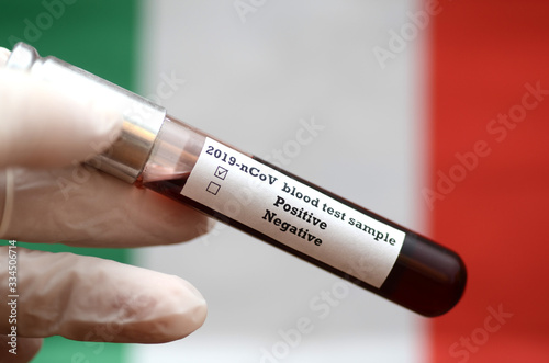 Stock photo of holding tube with Blood Test(novel Coronavirus 2019 disease,COVID-19,nCoV) and Italian flag. Italy virus outbreak.