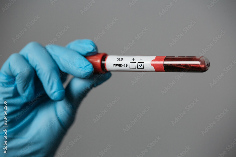 Obraz premium blood tests for the virus coronavirus covid 19