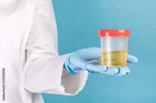 test tube with a urine test in the doctor's gloved hand