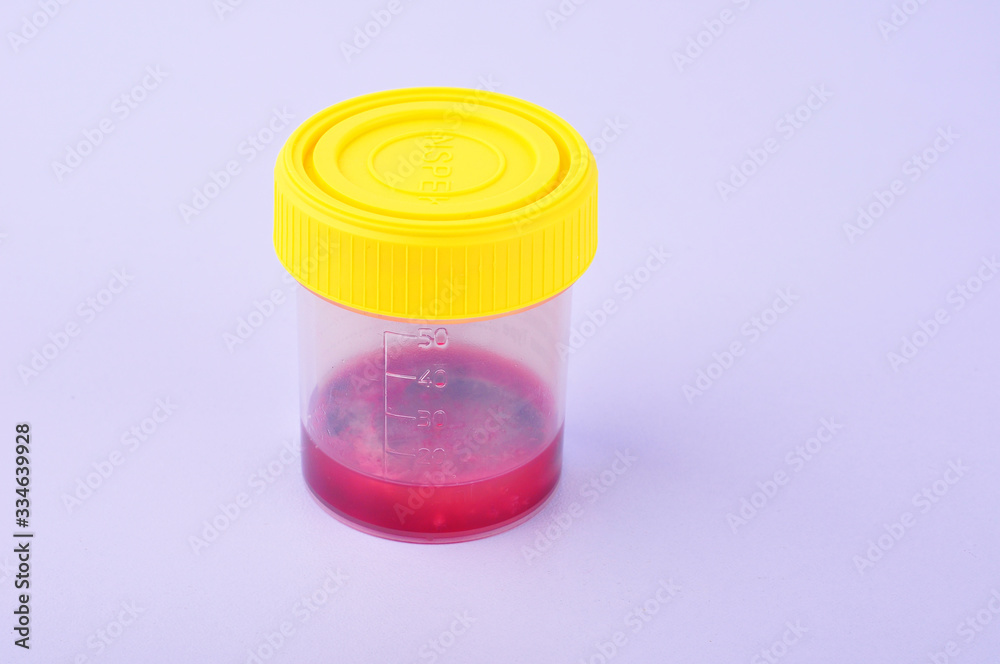 medical blood test on white background medical blood test on white background