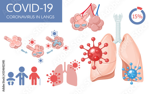 Human lungs. Sars disease, coronaviruses in the lung. Coronavirus