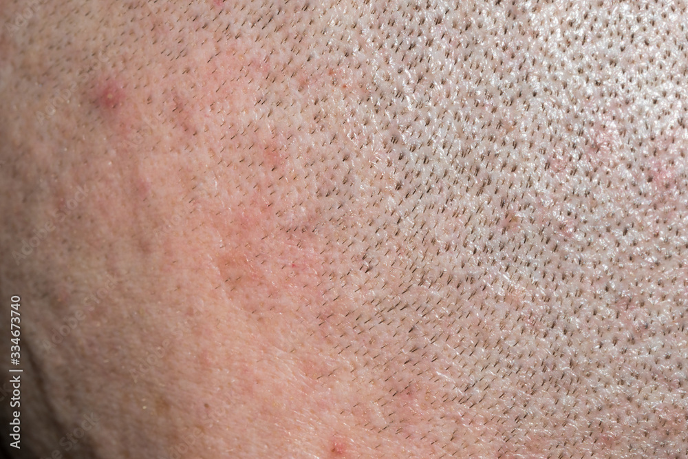 Fototapeta premium Macro photo of short hair on man head.
