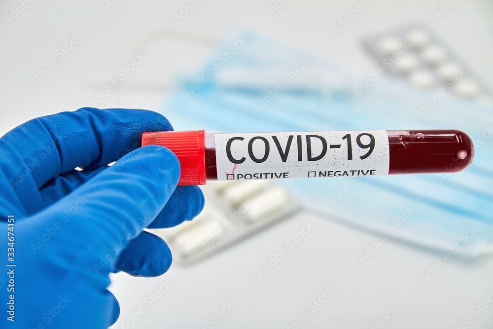 Conceptual photo. Hand holds a blood test sample for presence of coronavirus. Tube containing a blood sample that has tested positive for coronavirus. Conceptual photo. Hand holds a blood test sample for presence of coronavirus. Tube containing a blood sample that has tested positive for coronavirus.