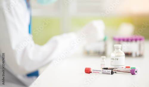 Blood test tube  for laboratory analysis.Laboratory testing patient   s blood samples.Conceptual image coronavirus  COVID-19  test tube sample that has tested positive for coronavirus.
