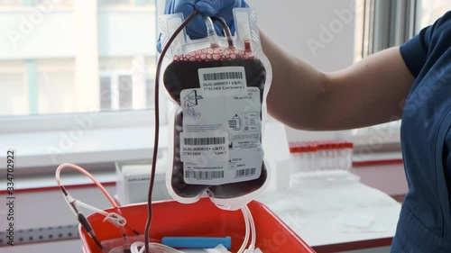 A nurse is holding plastic bag with blood of donors. Blood package sample. Blood transfusion and donation concept 4k