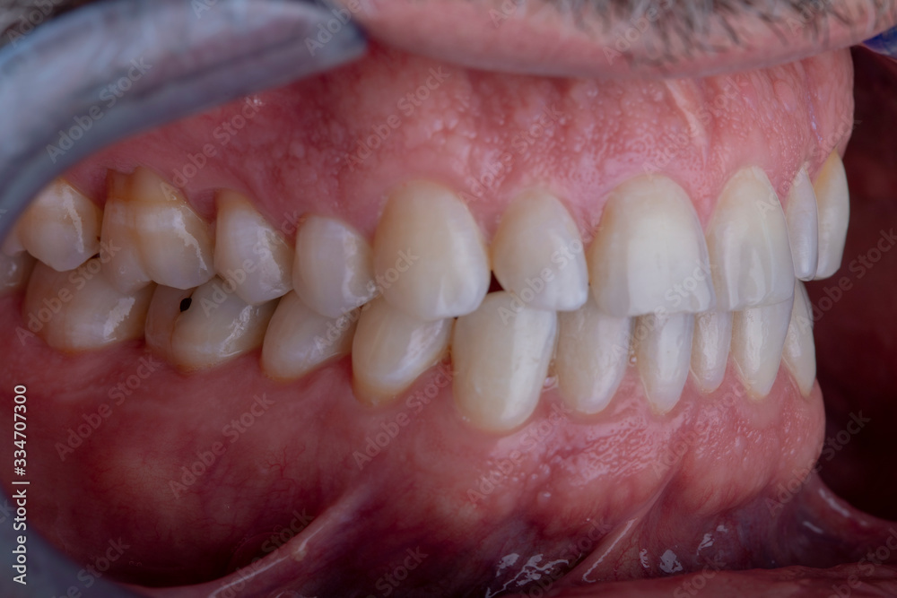 Fototapeta premium macro photo of human teeth