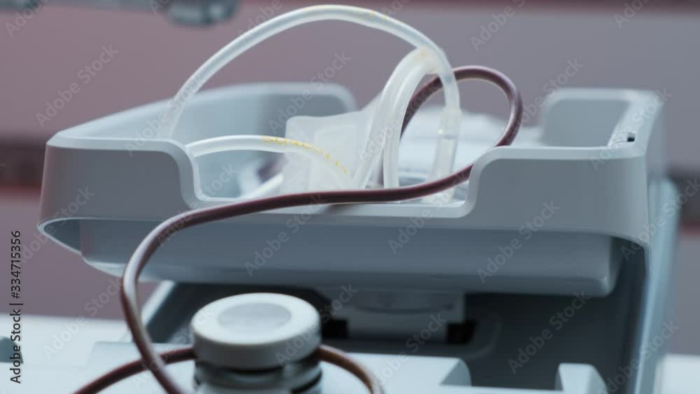 Plastic bag with tubes filled with blood. Blood transfusion station. Blood donation equipment in hospital 4k Plastic bag with tubes filled with blood. Blood transfusion station. Blood donation equipment in hospital 4k