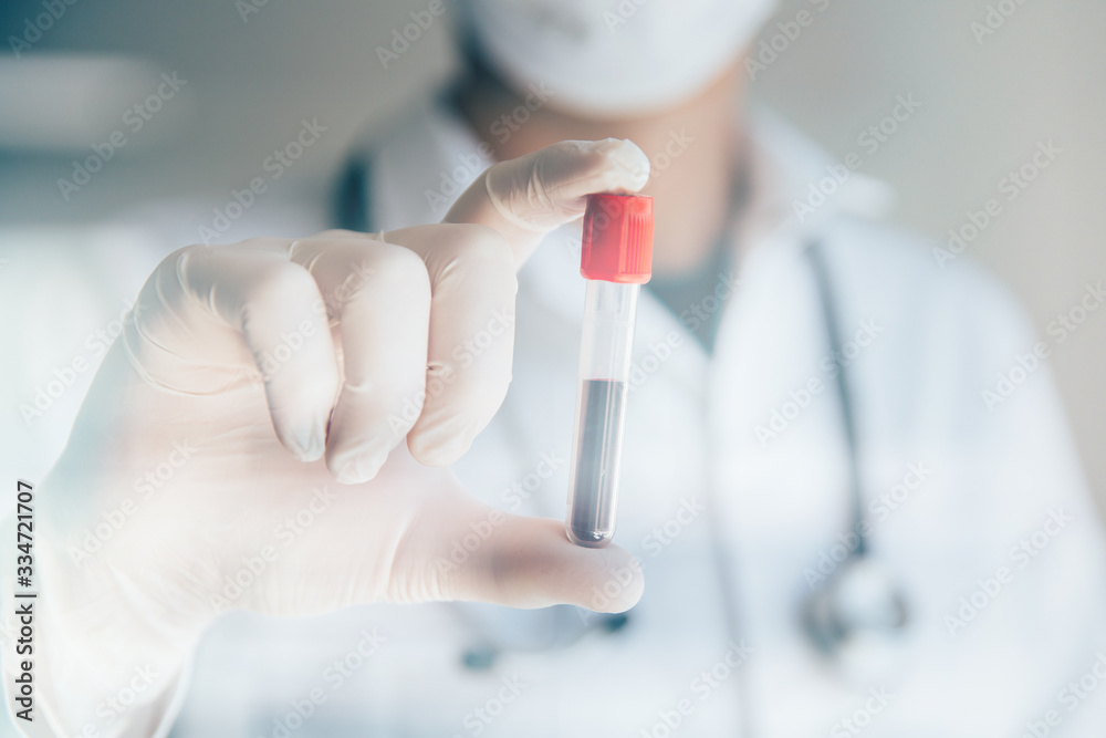 Doctor holding blood test. Pandemics outbreak crisis. Blood sample in a tube at lab. Doctor holding blood test. Pandemics outbreak crisis. Blood sample in a tube at lab.