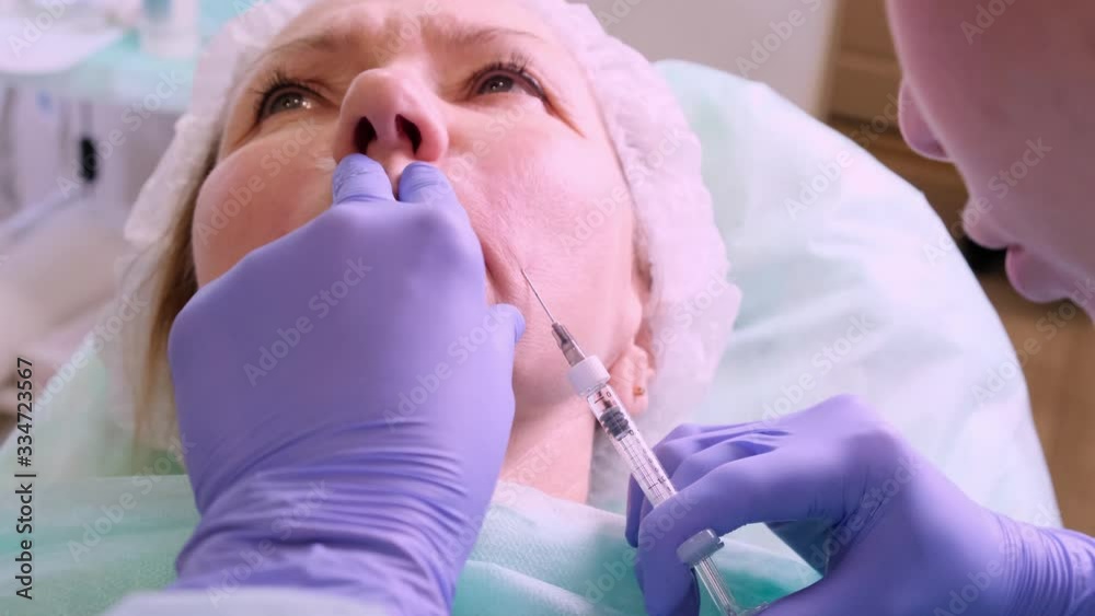 Middle aged woman 50 getting a lifting injection of an injection of hyaluronic acid into the face by a doctor cosmetologist. Cosmetic procedure. close-up Middle aged woman 50 getting a lifting injection of an injection of hyaluronic acid into the face by a doctor cosmetologist. Cosmetic procedure. close-up