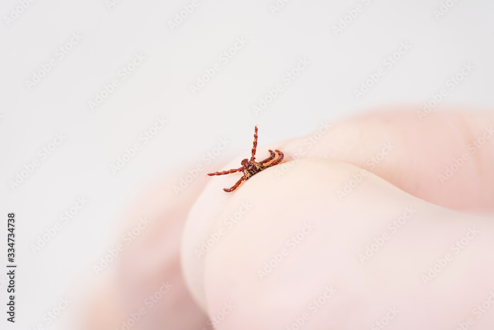 Fototapeta premium Danger of tick bite. Shows close-up mite in the hand in glove.