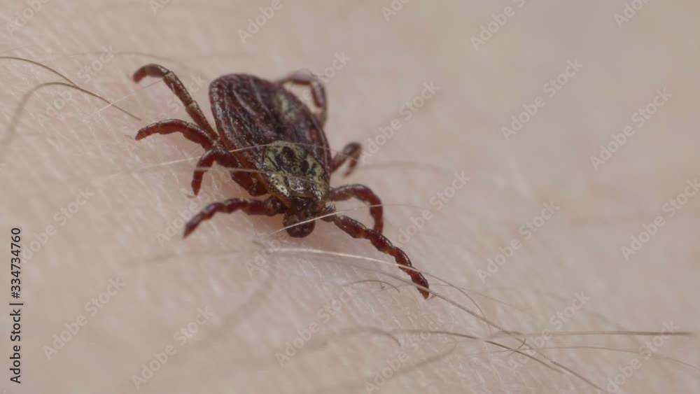 Blood-sucking mite tick tries to bite human skin Blood-sucking mite tick tries to bite human skin