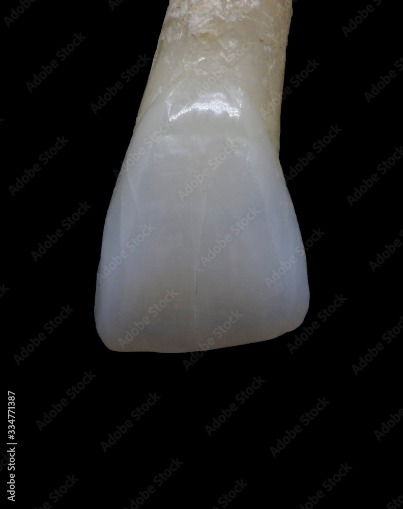 Close up of a natural tooth. Close up of a natural tooth.