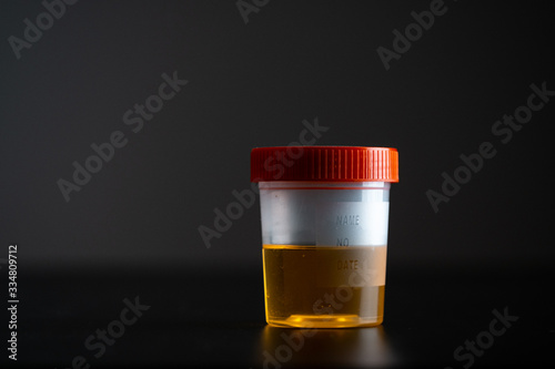 a jar with a urine test on a dark background