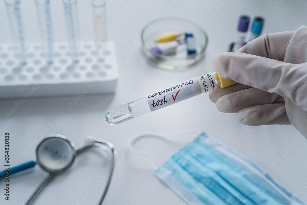 Coronavirus 2019-nCoV Blood Sample. Corona virus outbreaking. Epidemic virus Respiratory Syndrome. China. Covid-19