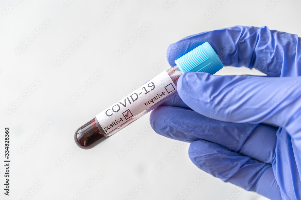 Obraz premium Coronavirus testing