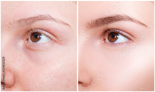 Female eyes closeup before and after eyebrows correction and dying. photo